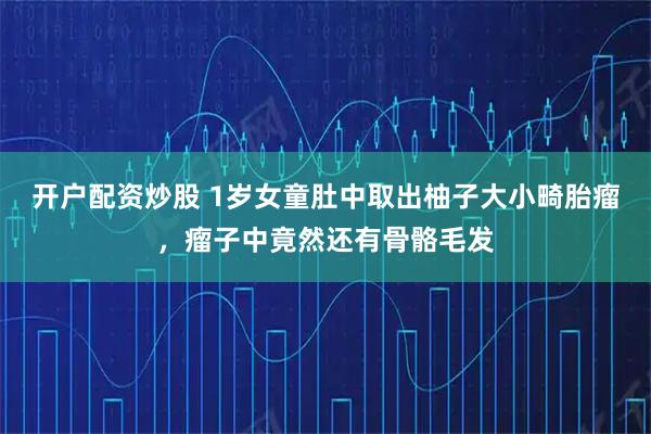 开户配资炒股 1岁女童肚中取出柚子大小畸胎瘤，瘤子中竟然还有骨骼毛发